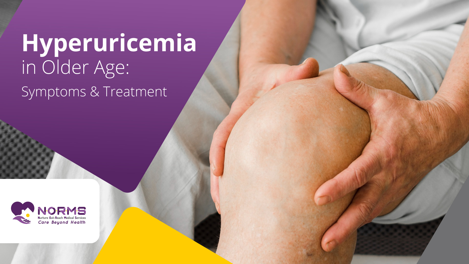 Hyperuricemia in older age: symptoms and treatment