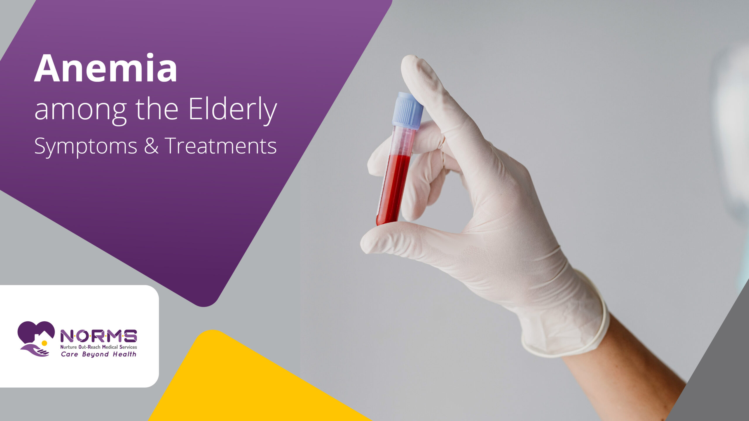 Anemia among the Elderly: Symptoms and Treatments