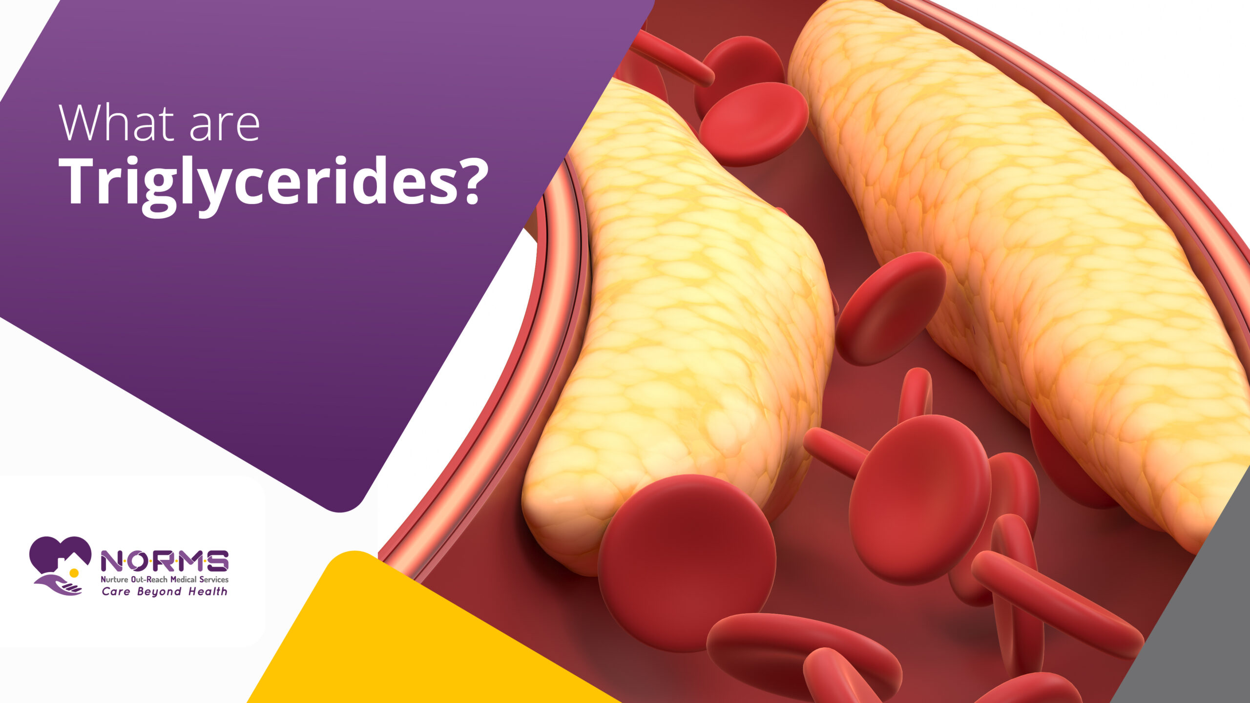 What are Triglycerides?